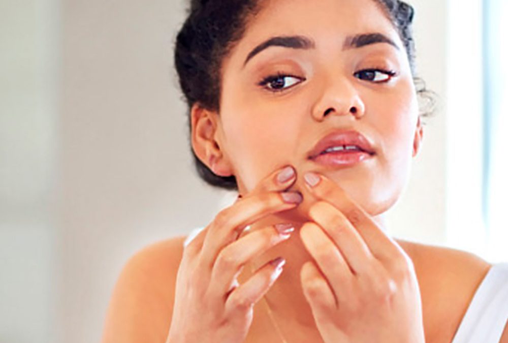 Qué es el acné hormonal y cómo puede ayudar a combatirlo una rutina de cuidado de la piel